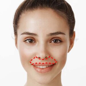 Bigote